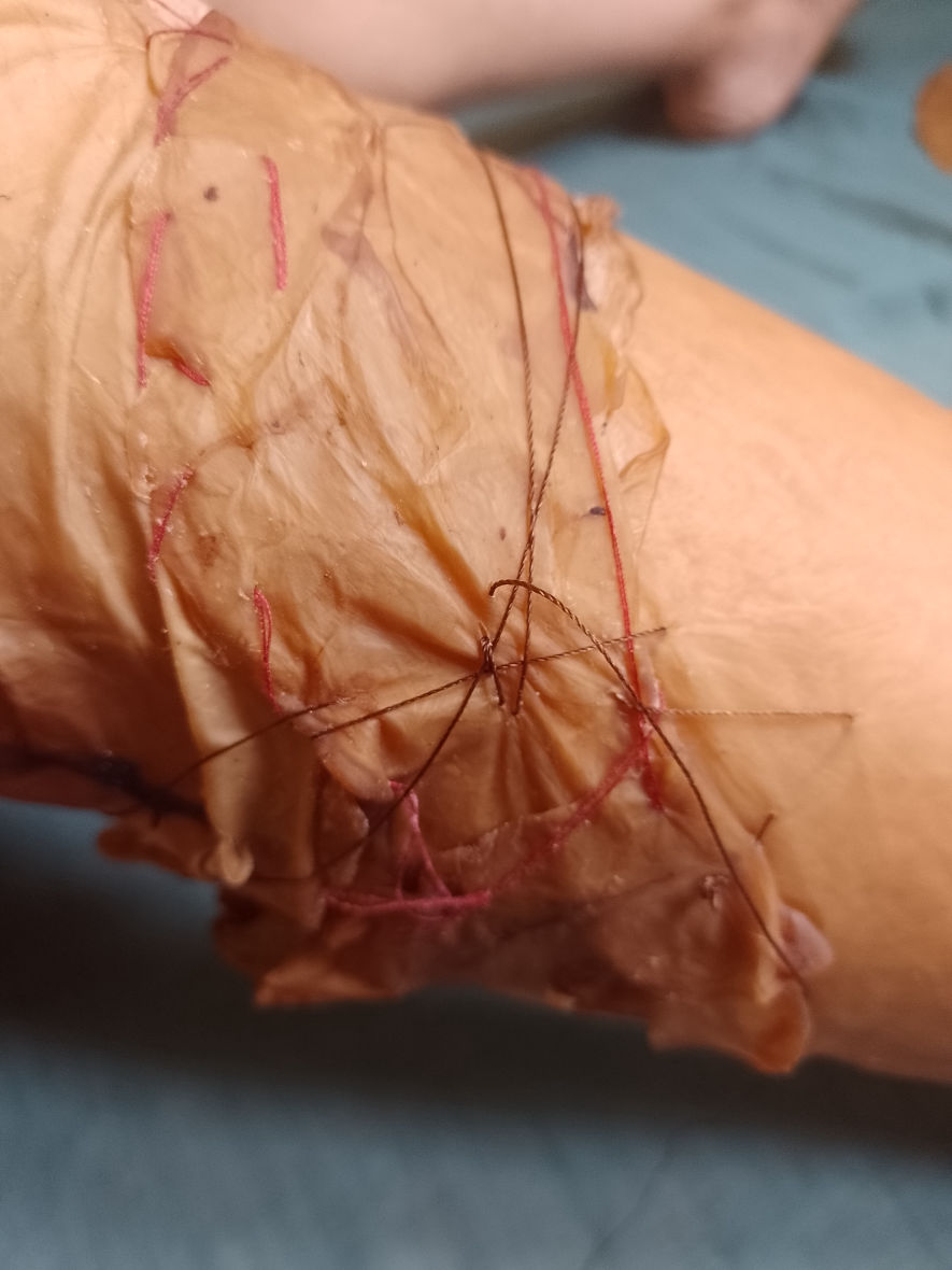 la nueva piel soledad belcuore
